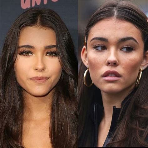 madison beer before plastic|Madison Beer Plastic Surgery: Quotes, Before, After Photos